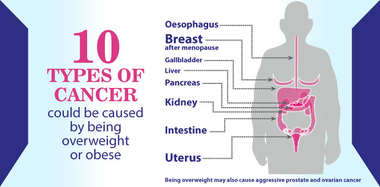 Obesity and Cancer