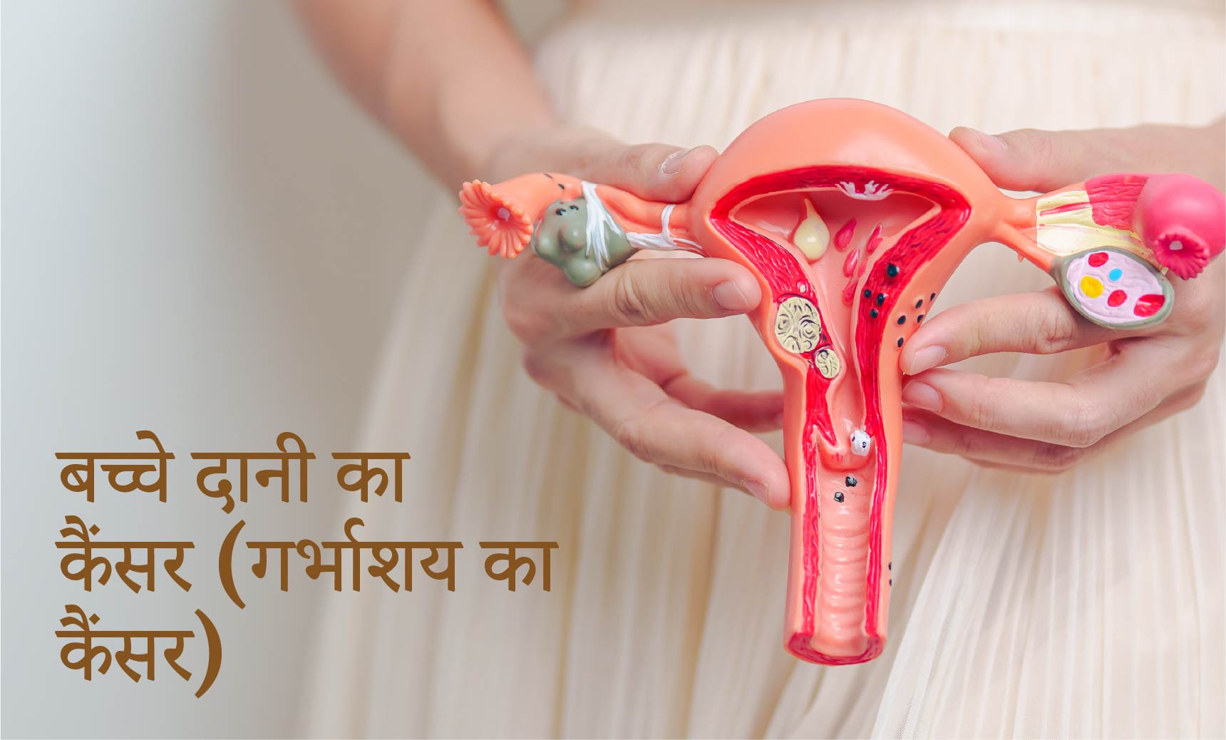 बच्चे दानी का कैंसर (गर्भाशय का कैंसर)