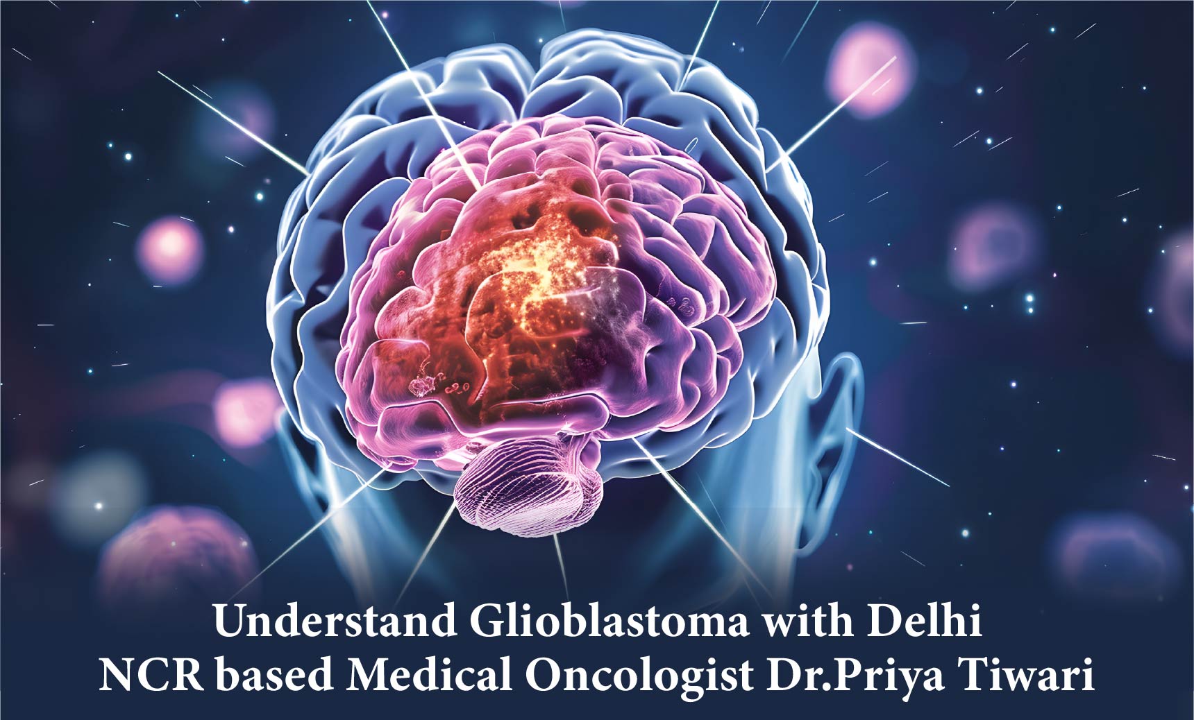 Understand Glioblastoma with Delhi,NCR based Medical Oncologist Dr.Priya Tiwari