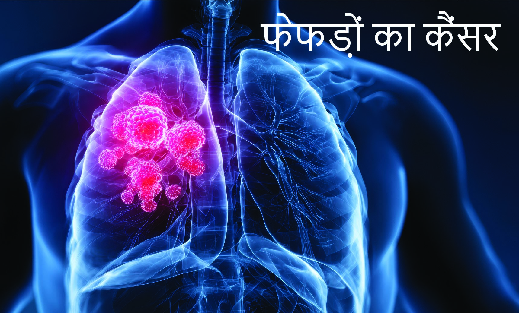 फेफड़ों का कैंसर | What is Lung Cancer in Hindi