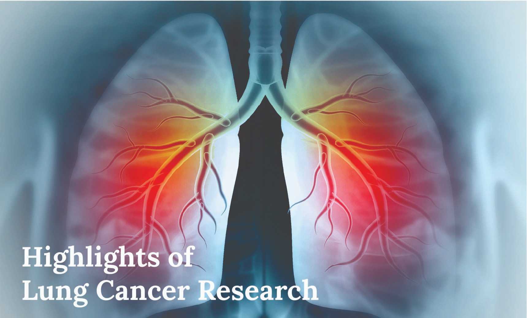 Highlights of Lung Cancer Research