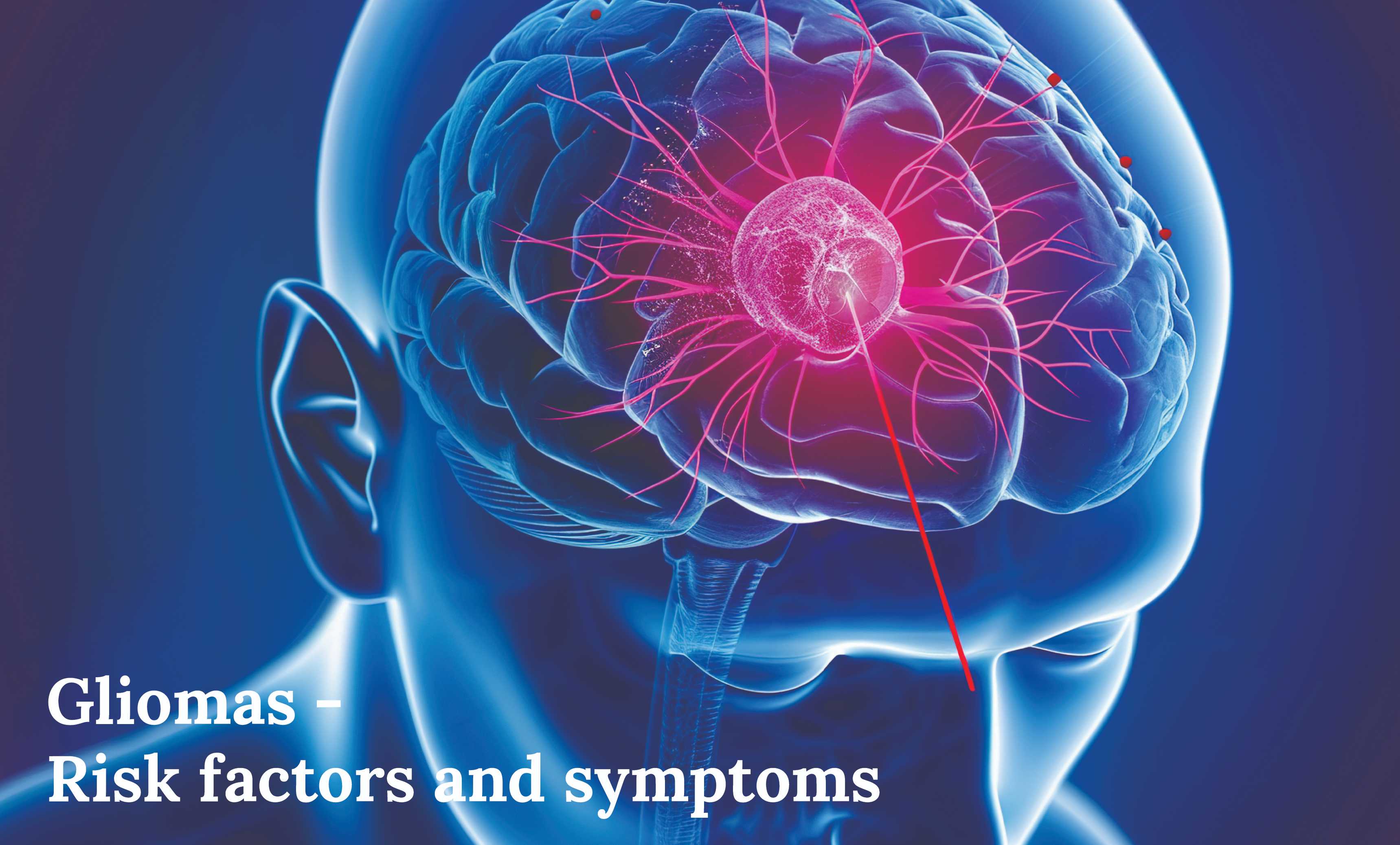 Gliomas - Risk factors and symptoms