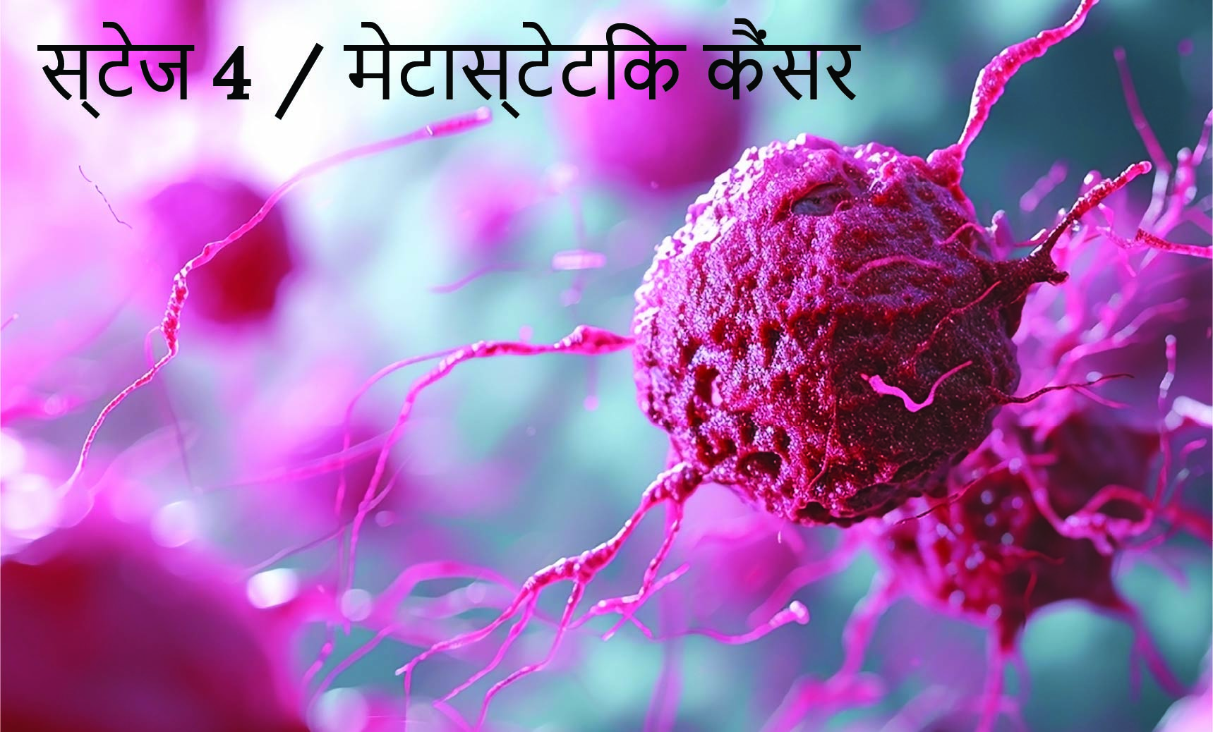 स्टेज 4 / मेटास्टेटिक कैंसर | Dr. Priya Tiwari