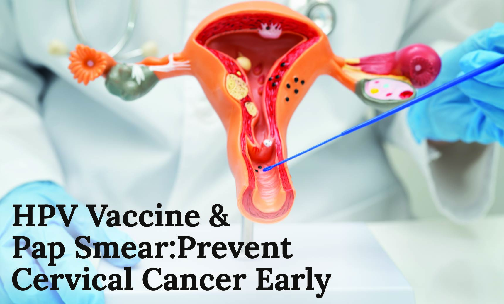 HPV Vaccine & Pap Smear: Prevent Cervical Cancer Early