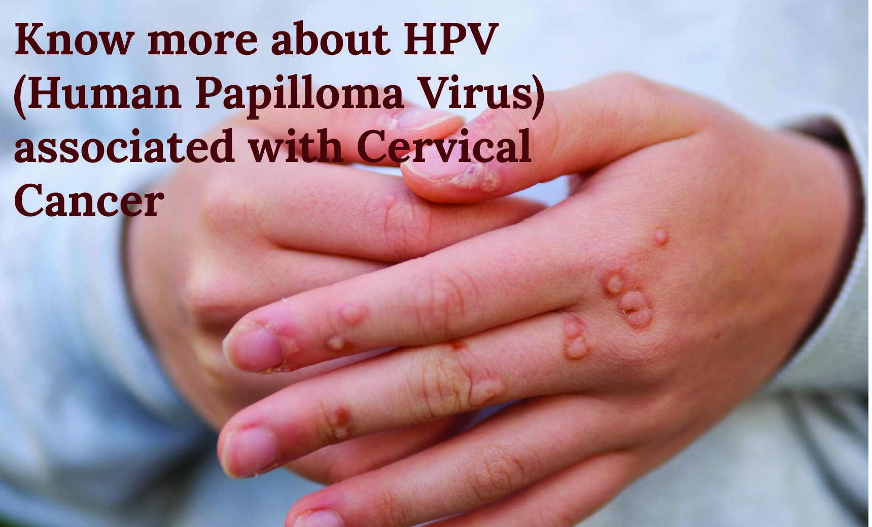 Know more about HPV (Human Papilloma Virus) associated with Cervical Cancer