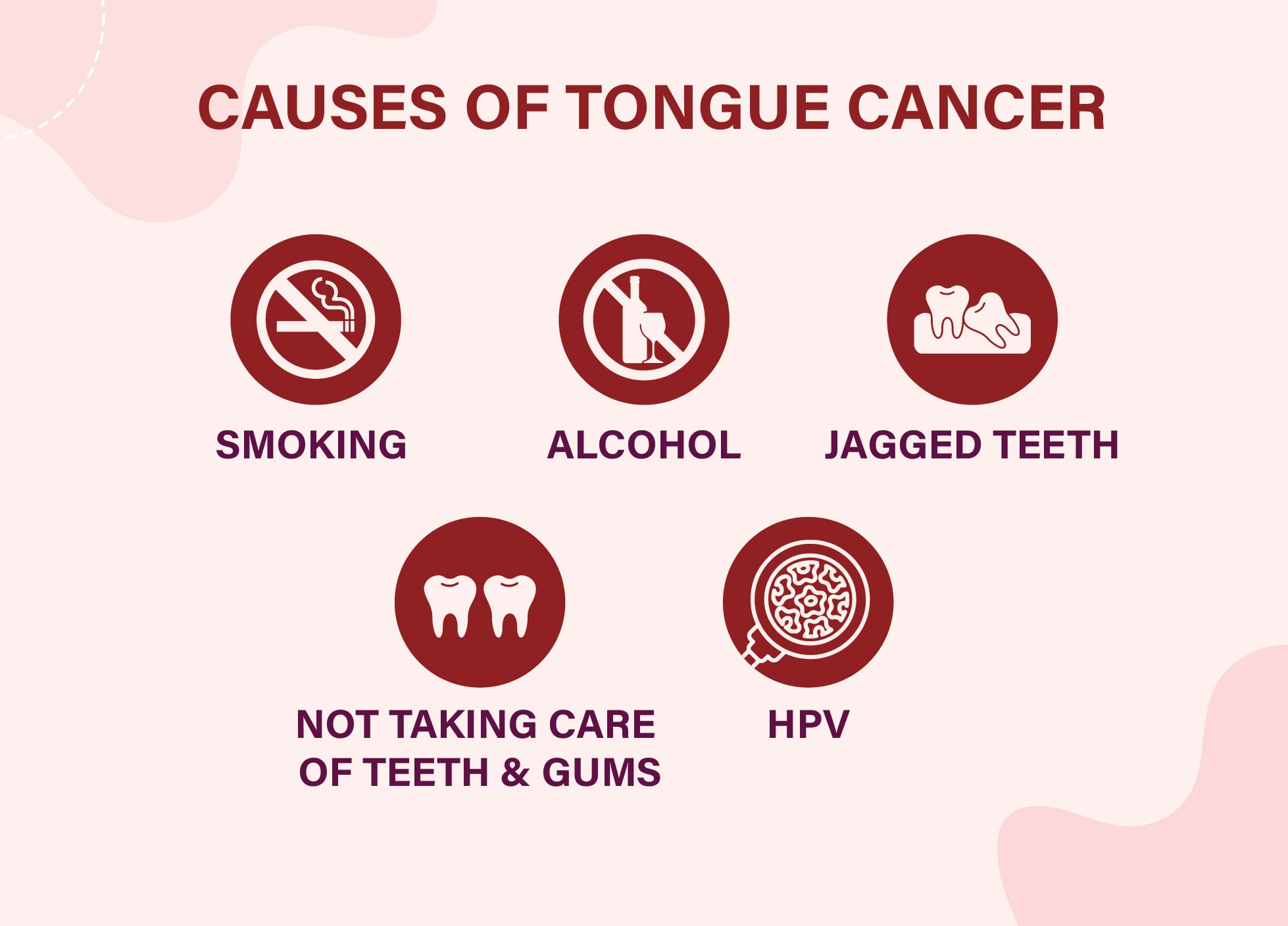 tongue cancer causes