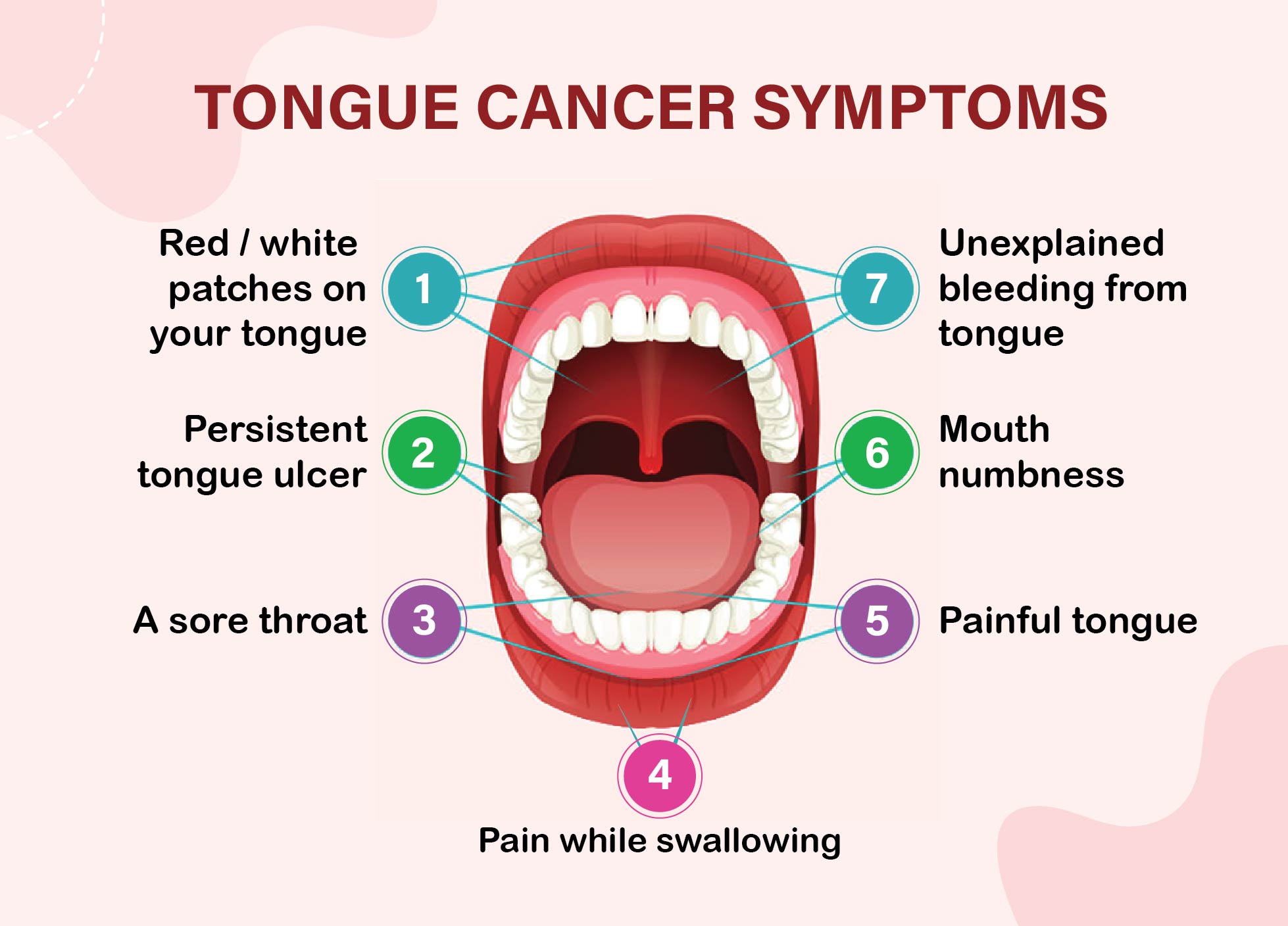 tongue cancer symptoms