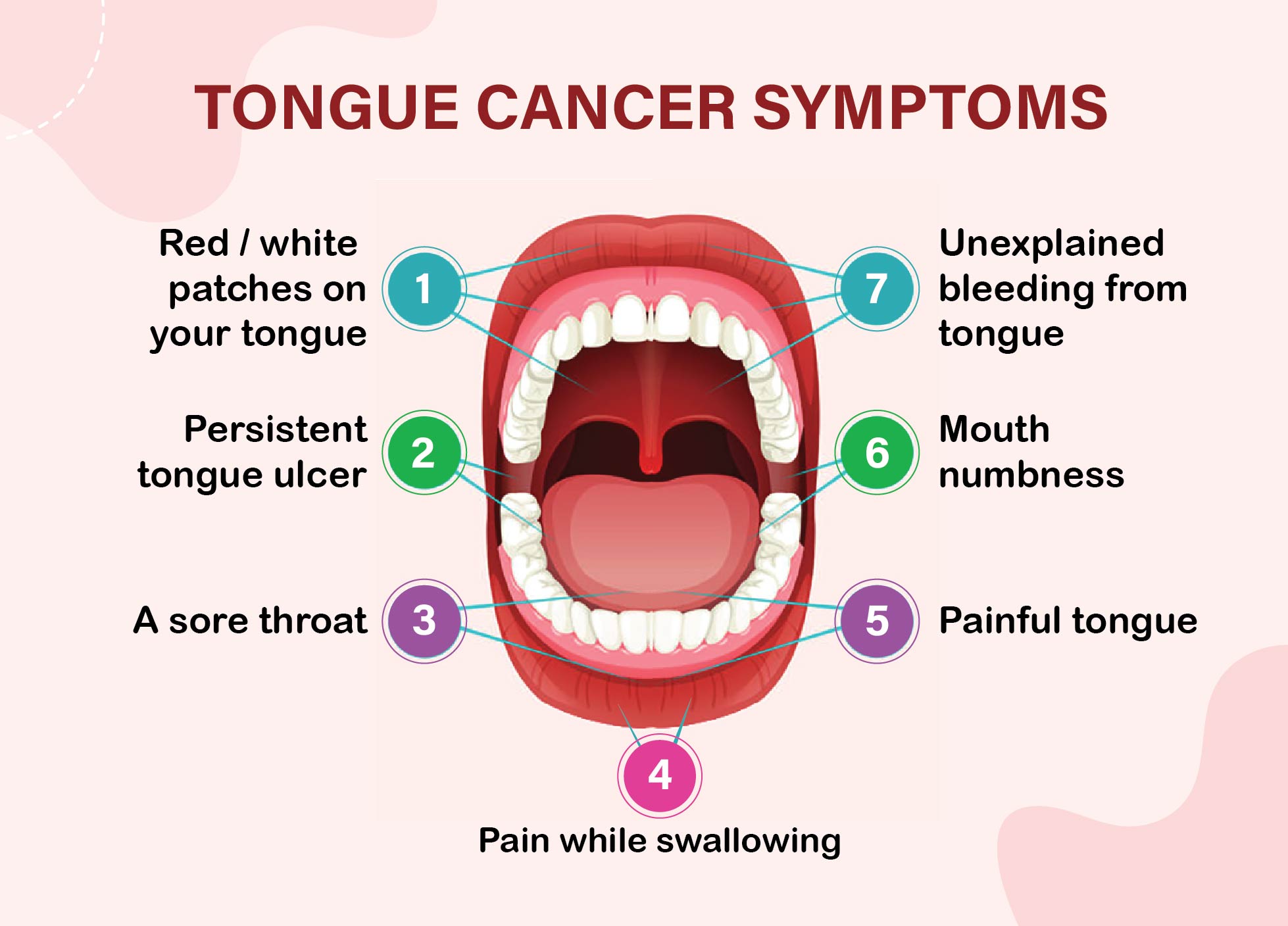 tongue cancer presentation